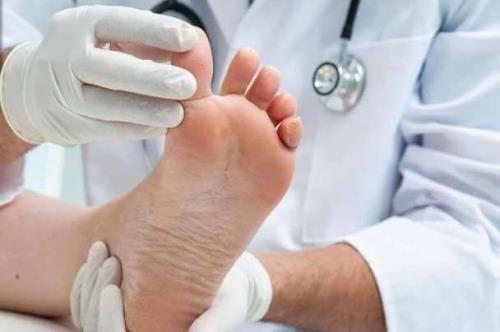 ساخت چسب حساس به فشار برای تعیین اندازه کفش