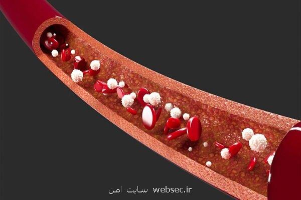 پایش لحظه ای غلظت دارو در خون با سنسور نانویی میسر شد